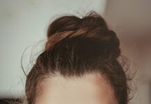 “팔 안쪽에 자꾸 뾰루지가 나요”… 여름철 ‘피지 과다성 뾰루지’, 청결보다 중요한 건? smiling woman holding cheek